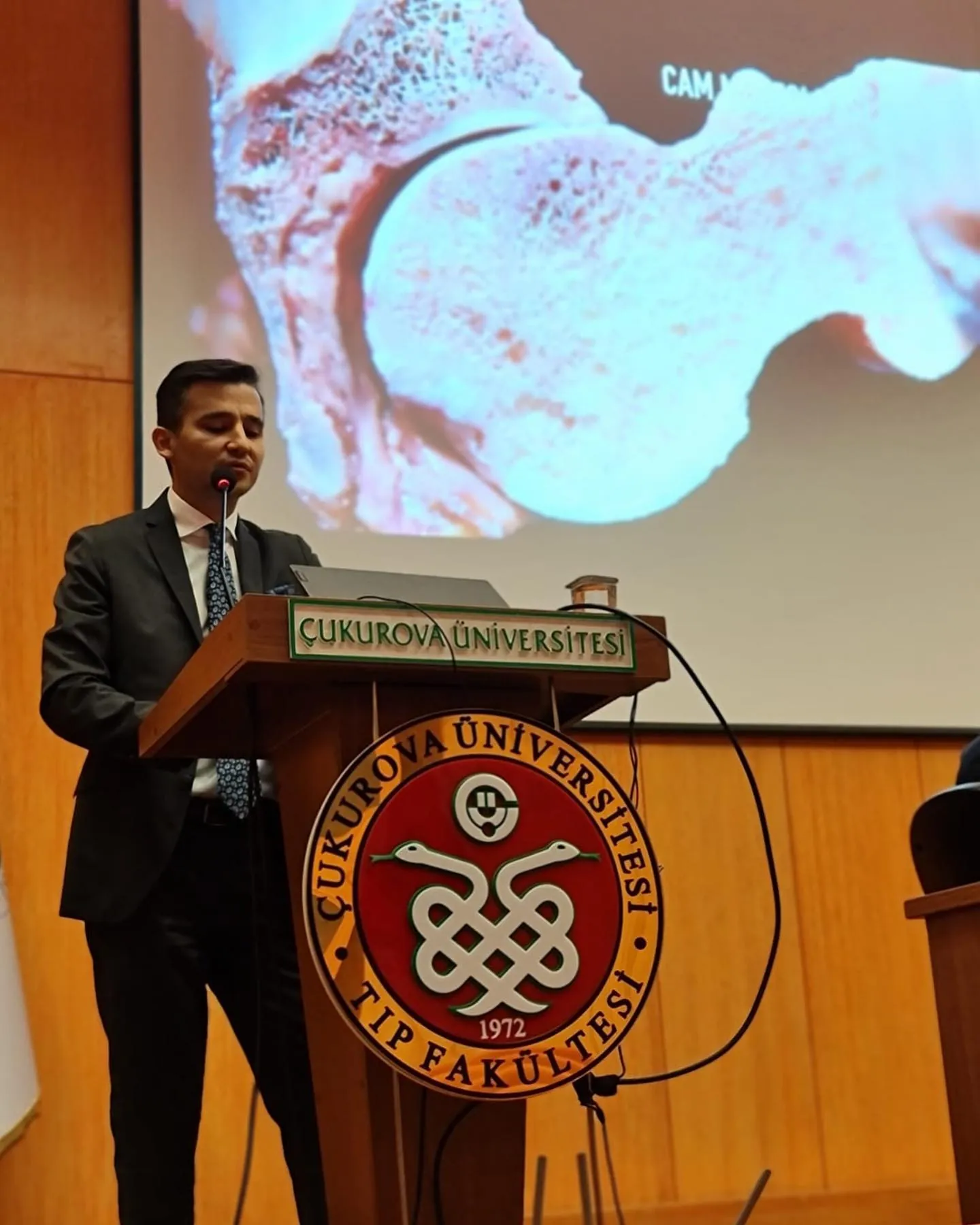 Prof. Dr. Safa Gürsoy, Çukurova Üniversitesi'ndeki TUSYAD toplantısında sunum yaparken